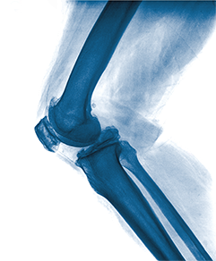 Коленный сустав